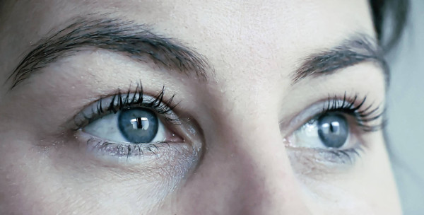 EMDR